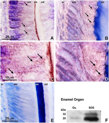 Intravesicular Phosphatase PHOSPHO1 Function in Enamel Mineralization and Prism Formation